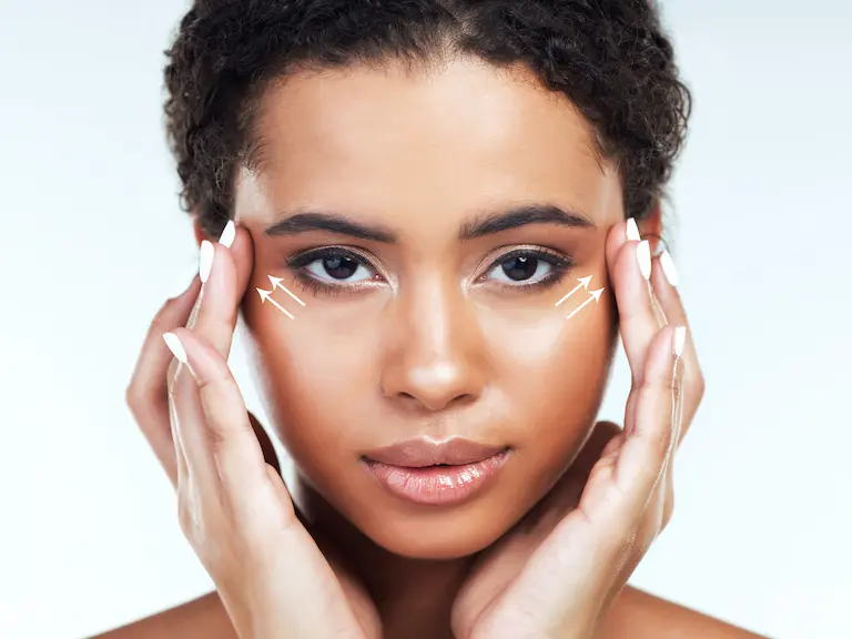 qu’est ce que la pose de fils tenseurs (threading) Luxembourg Femme tenant ses tempes avec les mains.